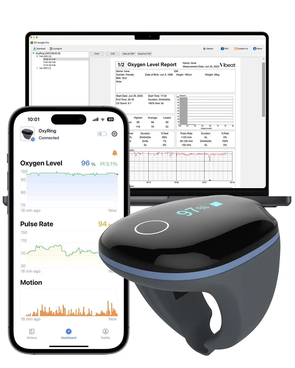 

Continuous Oxygen Monitor - Bluetooth Pulse Real-time Reminder & Free PC Report, Wearable Finger Ox