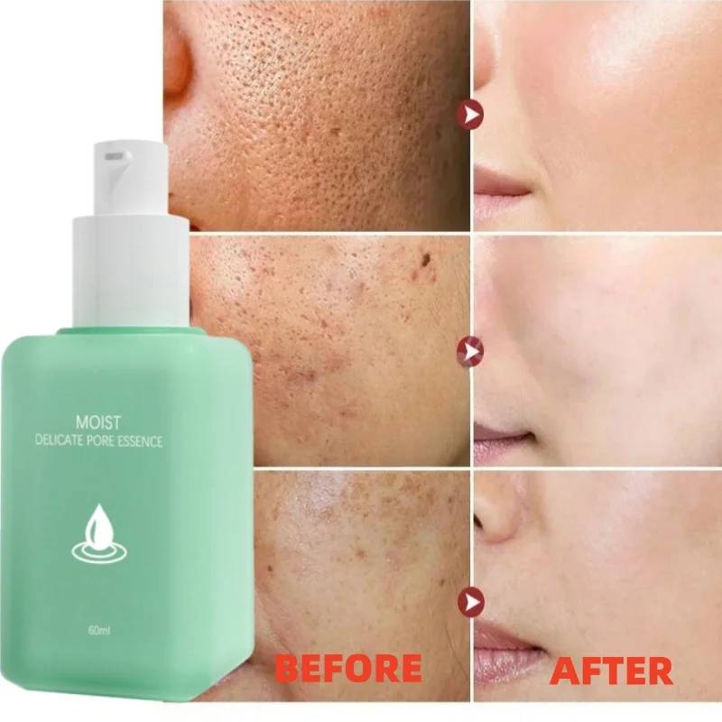 

Pore Shrinking Essence Reduce Large Pore Tighten Refining Face Repair Rough Dull Pore Brighten Moisturize Remove Blackheads Care