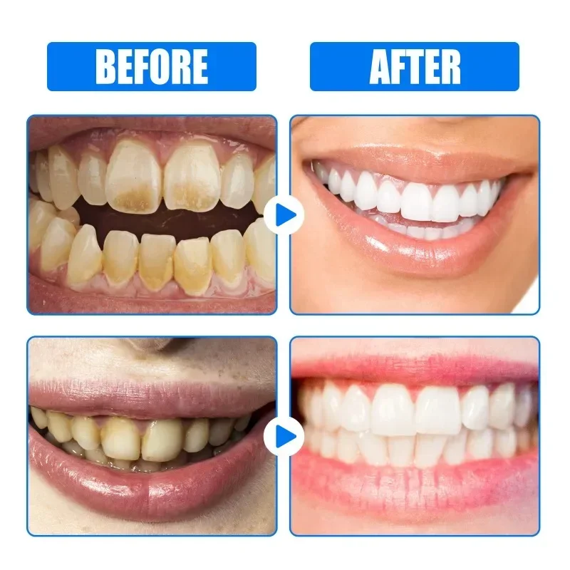 Pasta de dientes con sabor afrutado, blanqueador Dental profesional, Limpieza de dientes amarilla, reparación de dientes blanca brillante