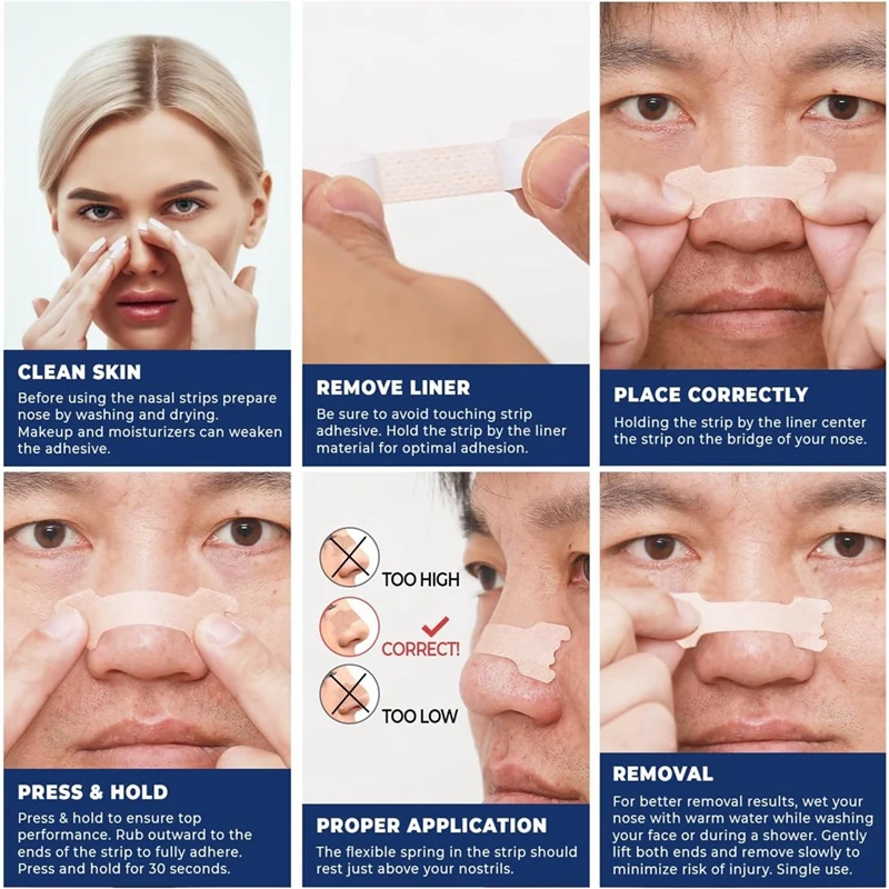 ABNO-Tiras nasas para ronco, fluxo de ar aprimorado, alivia a congestão nasal, força extra, solução anti-ronco, 30 contagens