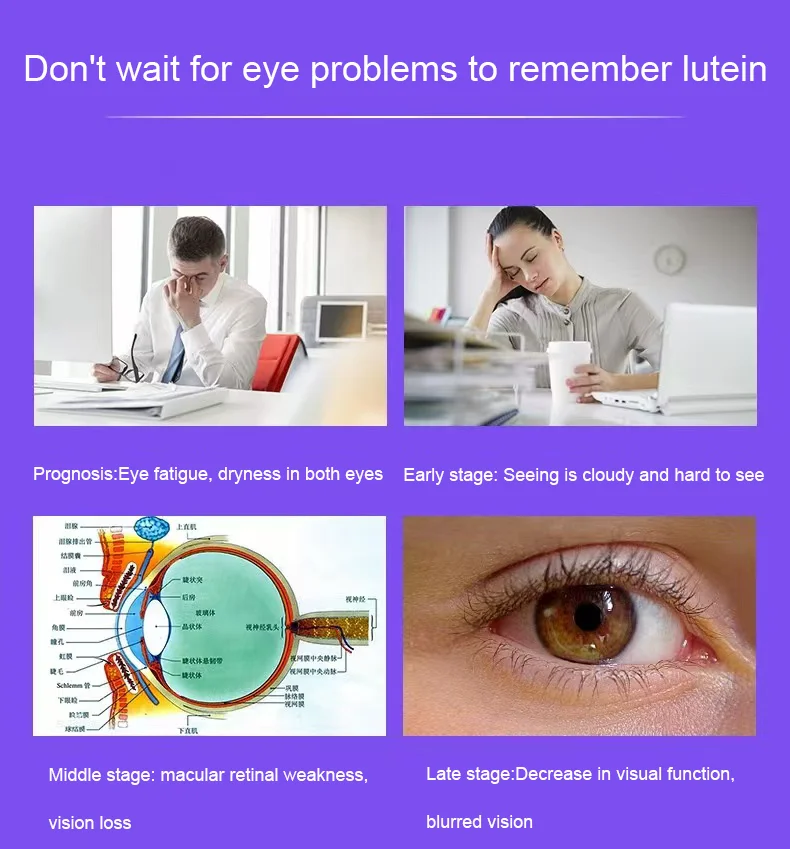 High Potency Lutein Capsules Relieve Eye Fatigue,Dry Eye and Vision Health,Prevent Blue Light,Prevent Myopia,Blueberry Extract