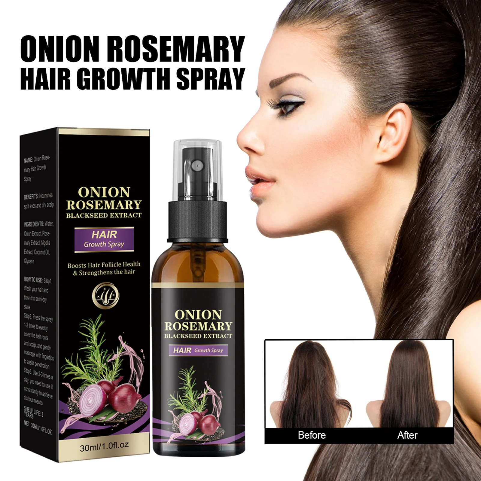 30ml Spray per la crescita dei capelli Cipolla Rosmarino Spray per capelli denso Olio essenziale di rosmarino Olio essenziale nutriente per capelli Spray anti-perdita di capelli