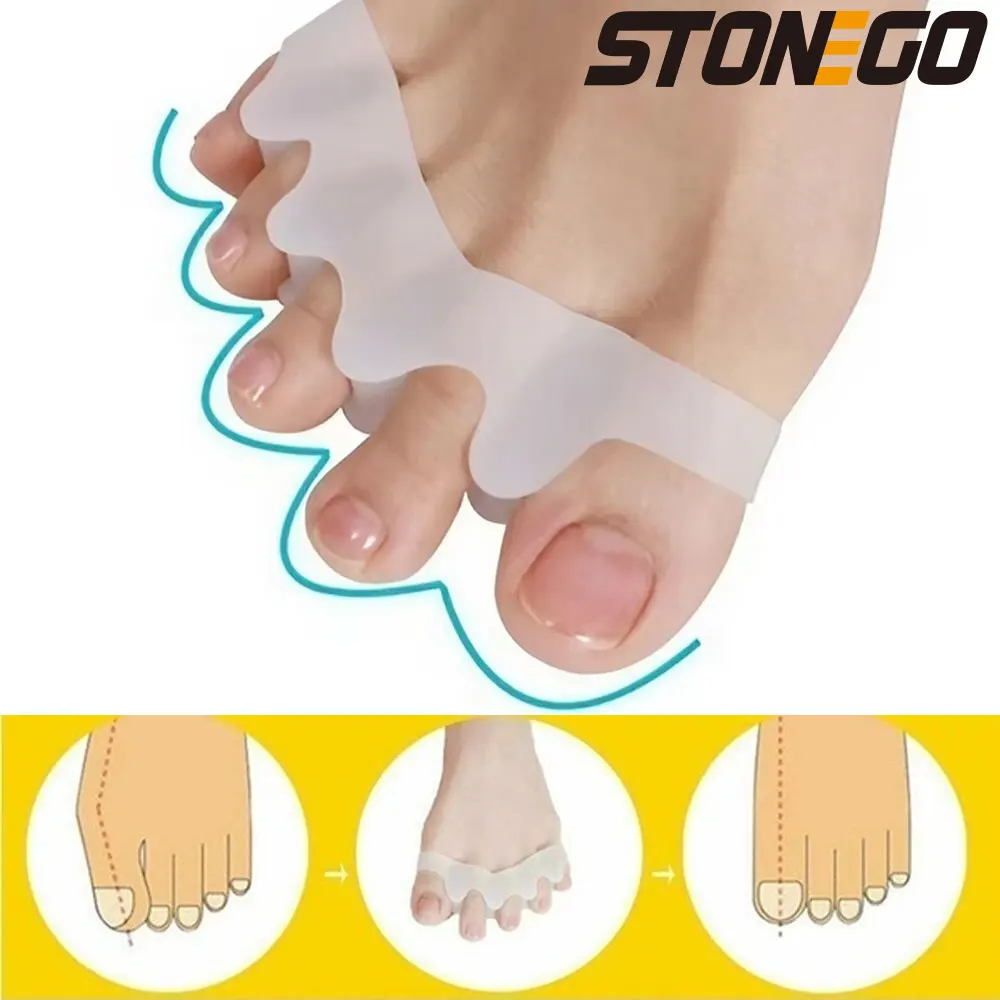 STONEGO Foot Bone Orthotic Device Silicone Hallux Valgus Corrector Toe Separators Bunion Correctors Foot Finger Splitter