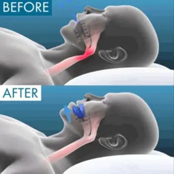 8 best sales Dil koruyucu - №8