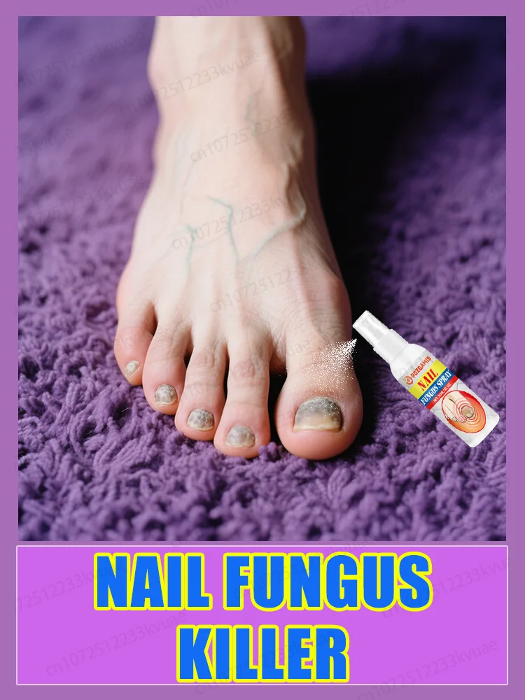 Fɪɢʜᴛ Aɢᴀɪɴsᴛ Oɴʏᴄʜᴏᴍʏᴄᴏsɪs, Lᴇᴛ Nᴀɪʟs Rᴇᴛᴜʀɴ ᴛᴏ ᴀ Hᴇᴀʟᴛʜʏ Sᴛᴀᴛᴇ