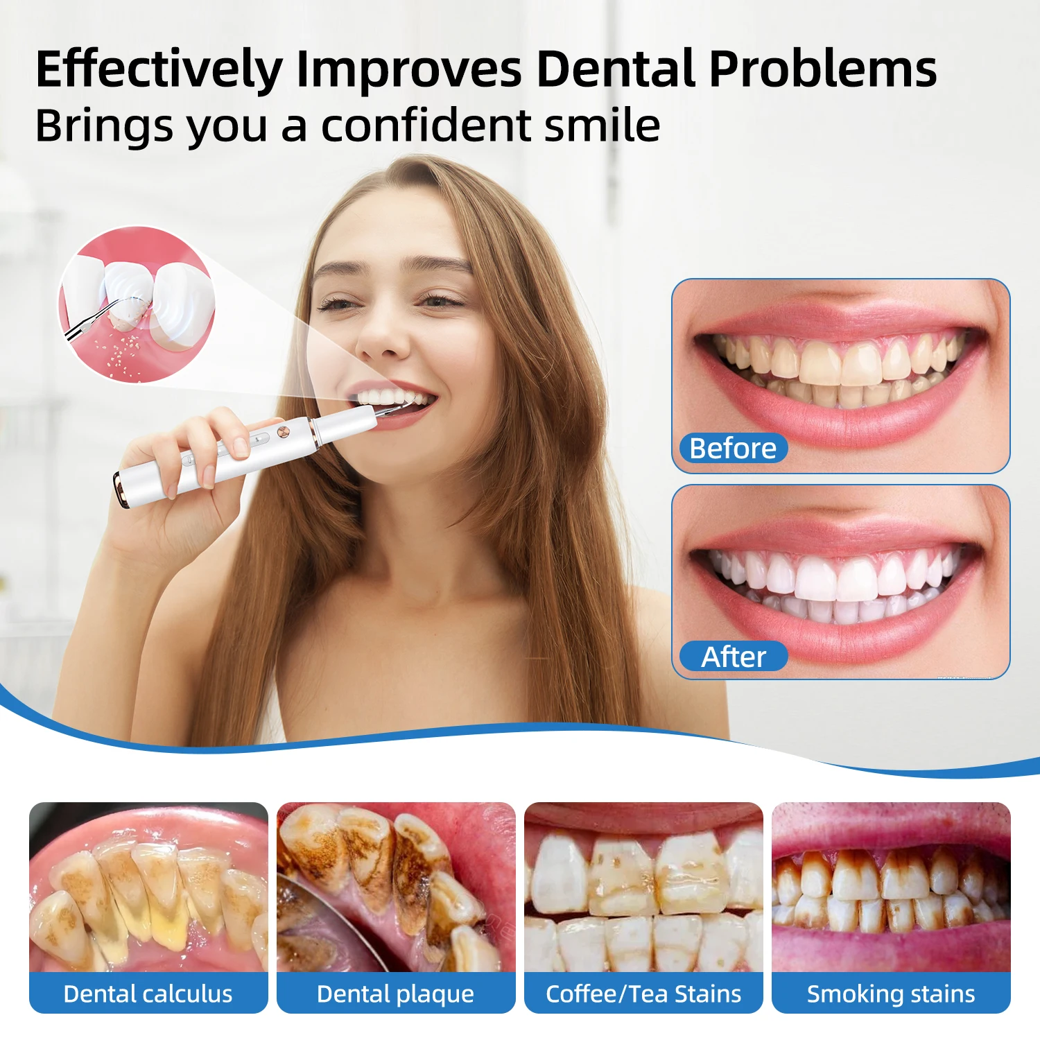 Ultrasonic Dental Scaler For Teeth Tartar Stain Tooth Calculus Remover Electric Sonic Teeth Plaque Cleaner Dental Stone Removal