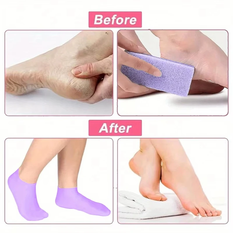 Moisturizing Foot Socks Silicone Socks for Dry Cracked Feet Women's Foot Socks for Moisturizing Featuring Massage