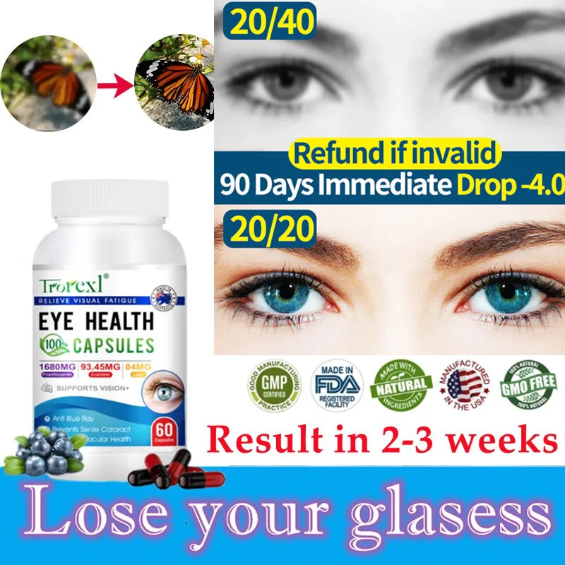 High Potency Lutein Capsules - Relieve Eye Fatigue, Dry Eye and Vision Health, Prevent Blue Light, Prevent Myopia