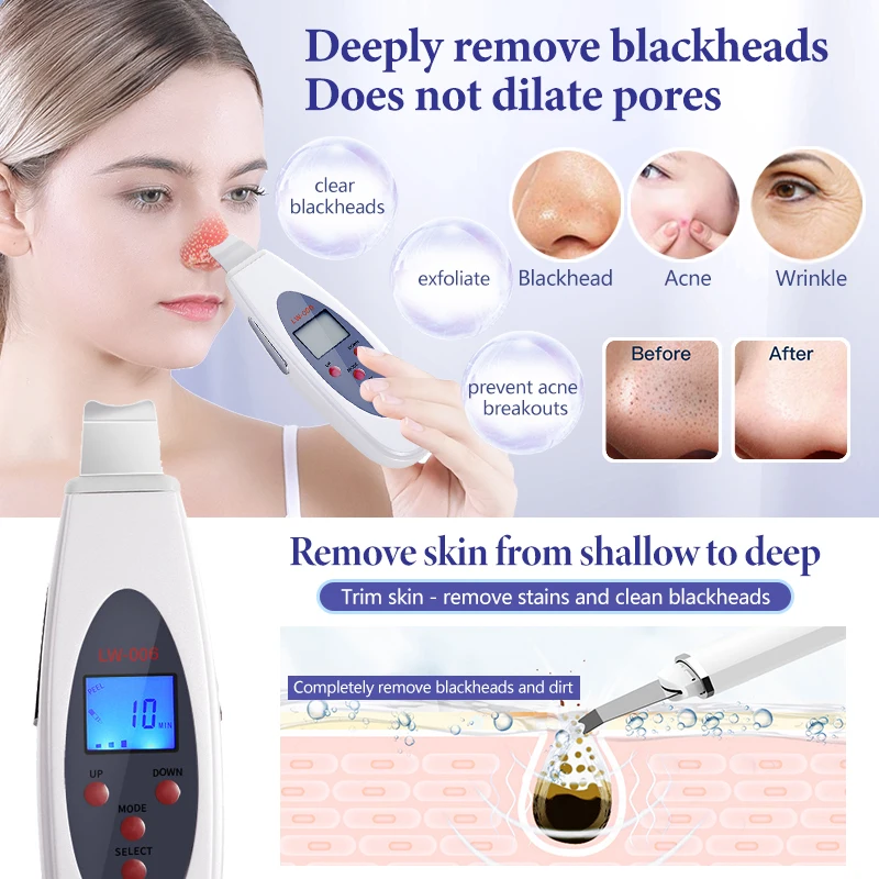 Ultrasonic Skin Scrubber Deep Face Cleaning Machine RemoveFacial Massager Ultrasound Peeling Clean Tone Lift LW006