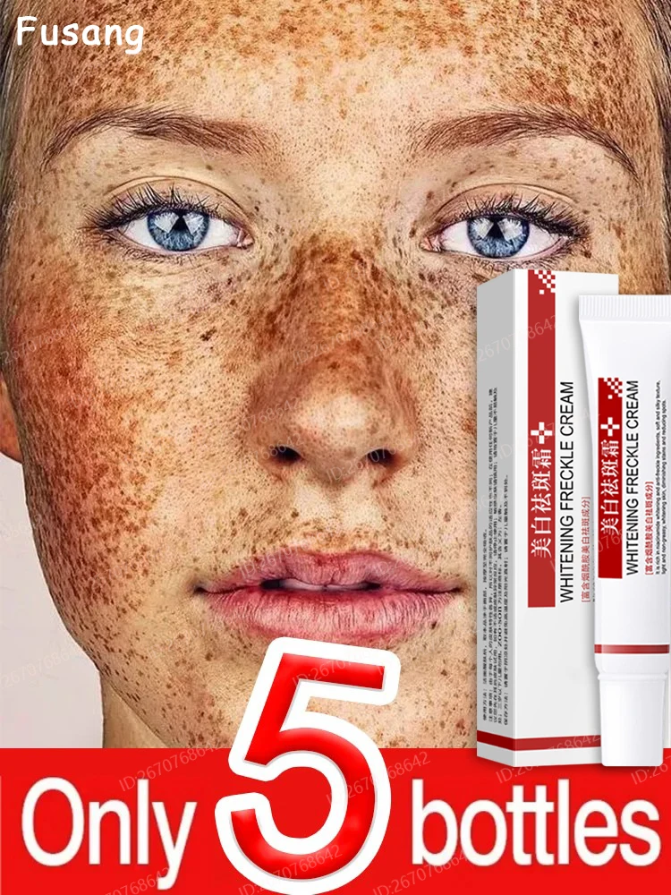 

Effective Whitening Freckle Cream Women Face Removing Melasma Emulsion Fade Dark Spots Remover Chloasma Cream For Reduce Sunburn