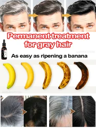 Anti gray hair ,Gray hair killer nourishes hair & restores natural color, 100% Effective for all types of people