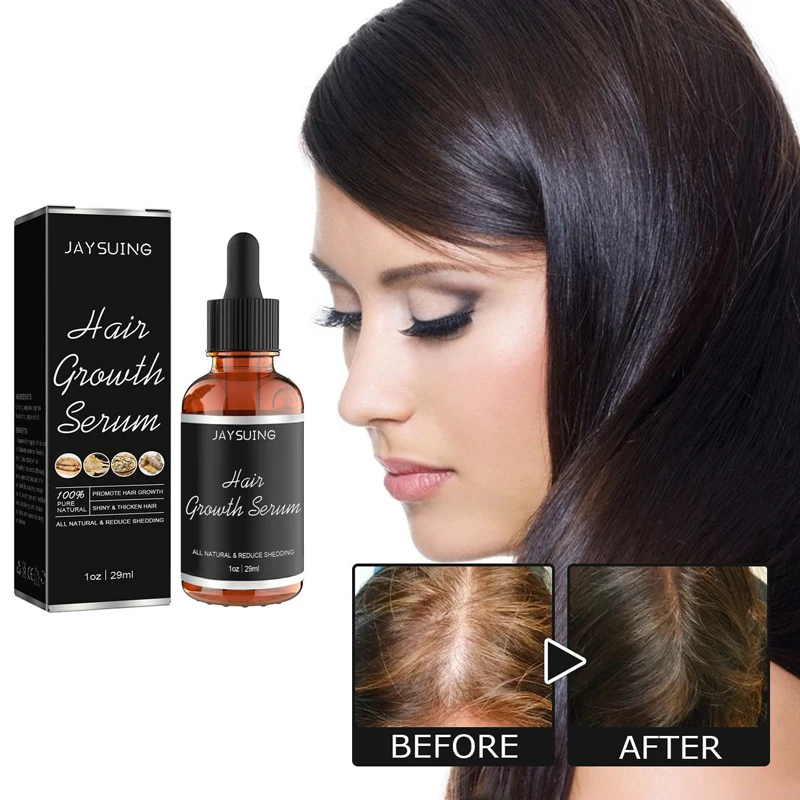 

Dense hair essence prevent hair loss firm hair strengthen firm moisturize and protect