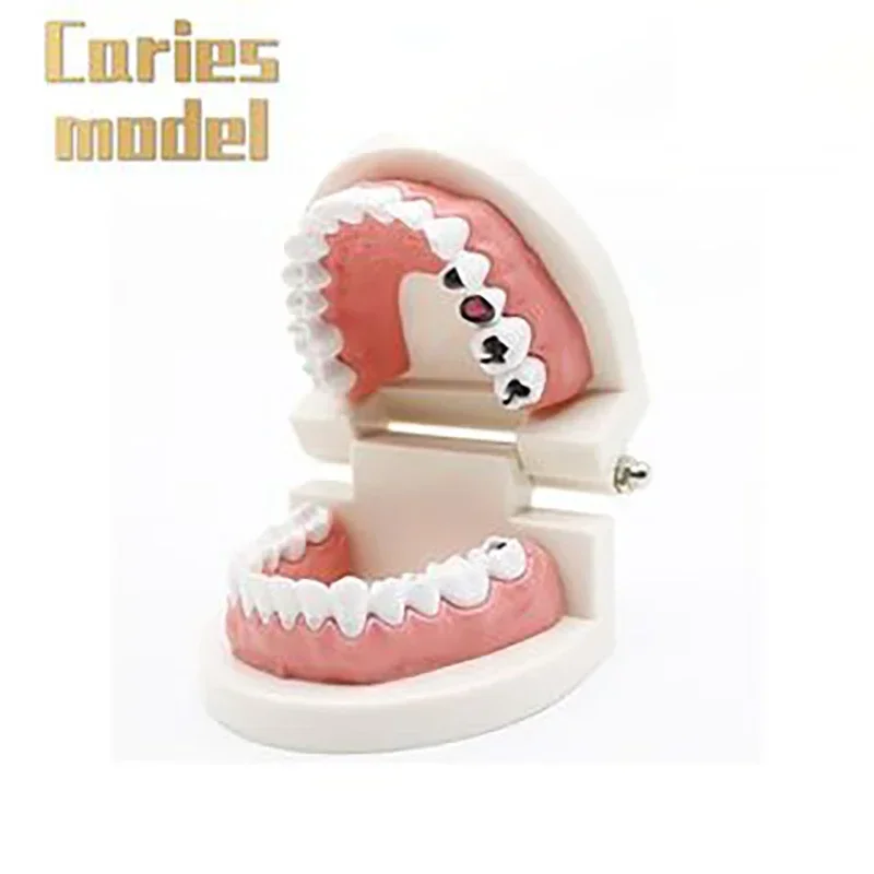 

Tooth Model Caries Model Caries Mold Dental Teaching Model Dentures Display Children Brushing Practice Demonstration Guidance