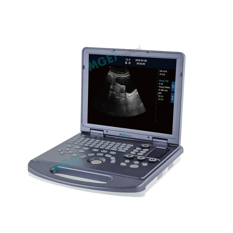 MEDIGE UMWD36 China Medical Instruments Multiprobe Sonography Human B/W Ultra Sound Scan 2D Laptop Ultrasound Machine Portable