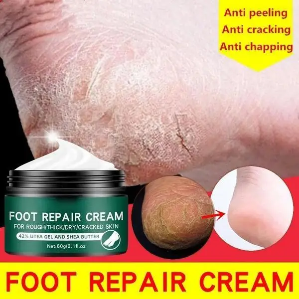 Newest Hand and Foot Skin Repairing Moisturizer Cream Anti-Chapping for Rough Dry and Cracked Chapped Feet Heel Repair Foot