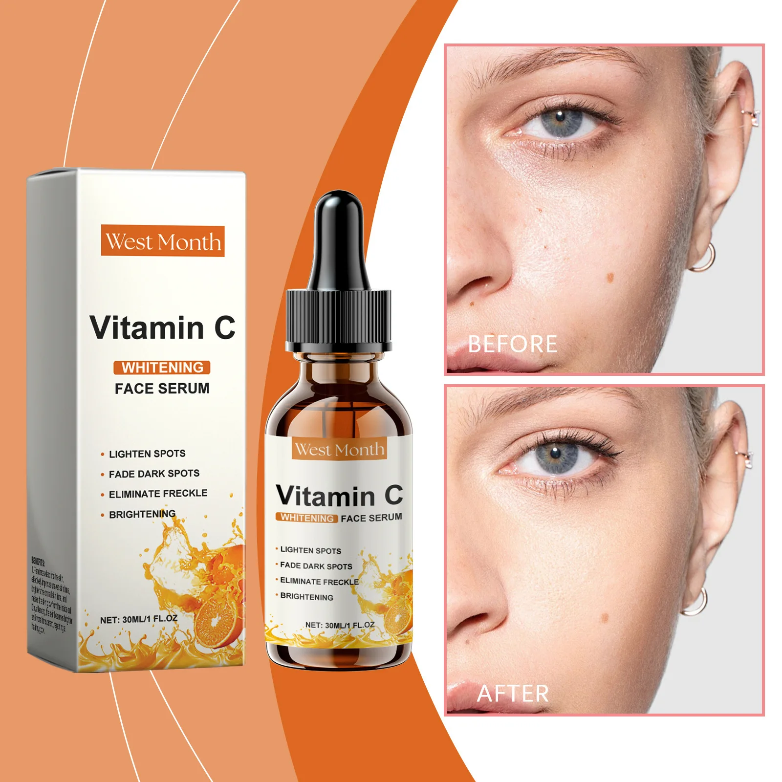 Vitamin C Whitening Serum Remove Freckles Dark Spots Face Essence Fade Melasma Melanin Brighten Repair Dull Skin Care Cosmetics