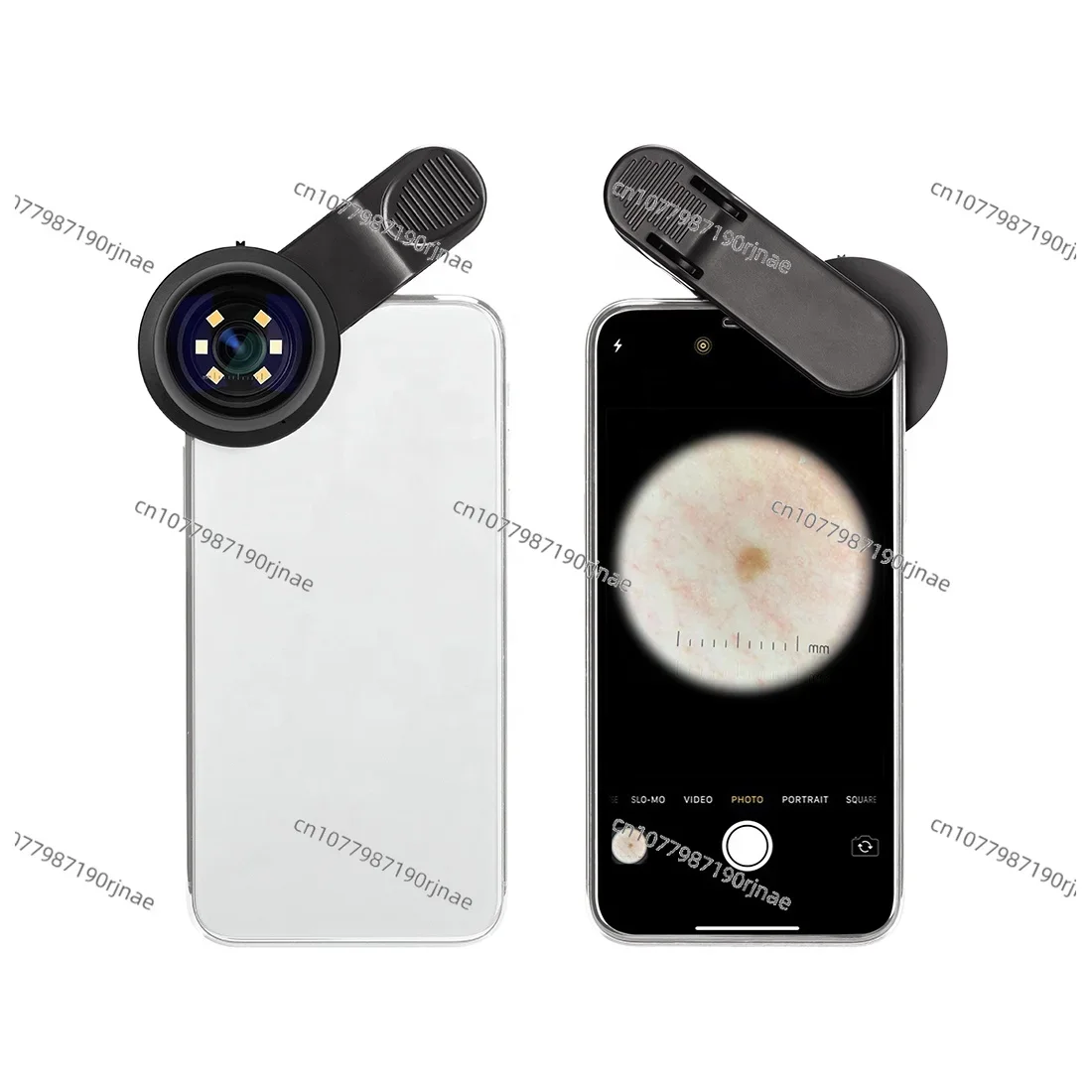 IBOOLO DE-300 Polarized and Non-Polarized Optical Dermatoscope