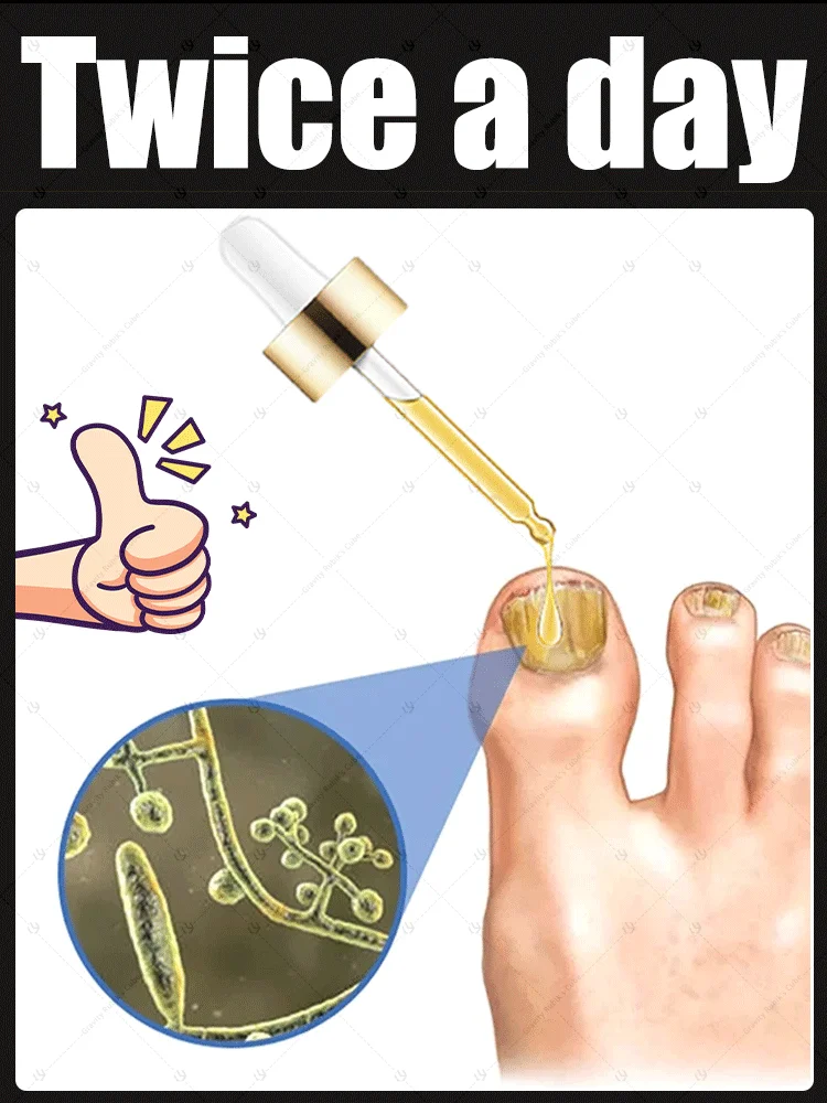 

foot nail fungus treatment