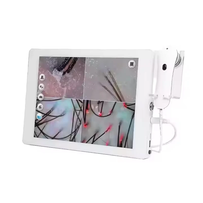 

Popular and Analyzer Machine Analysis Treatment for Hair Loss Scalp Hair Follicle Detector