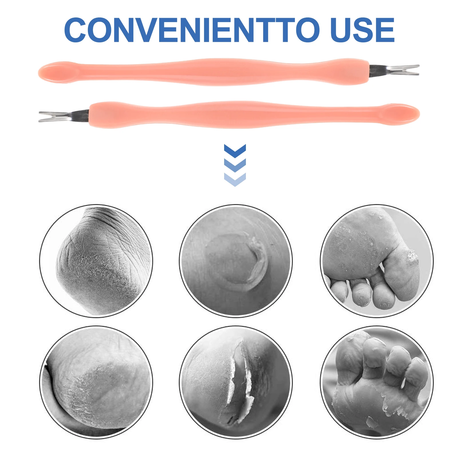 5-delige nagelriemschuiver gereedschapsset nagel ruwe huid schraper manicure benodigdheden metalen nail art gereedschapsset professioneel gebruik