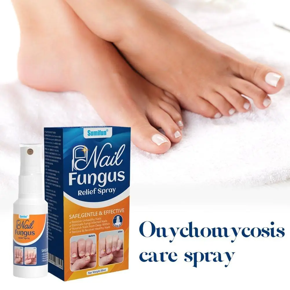 

30ml Nail Repair Spray Treatment Effective Toe Nail Care Liquid For Onychomycosis Paronychia Fungal Infection ReliefSerum 1/5PCS
