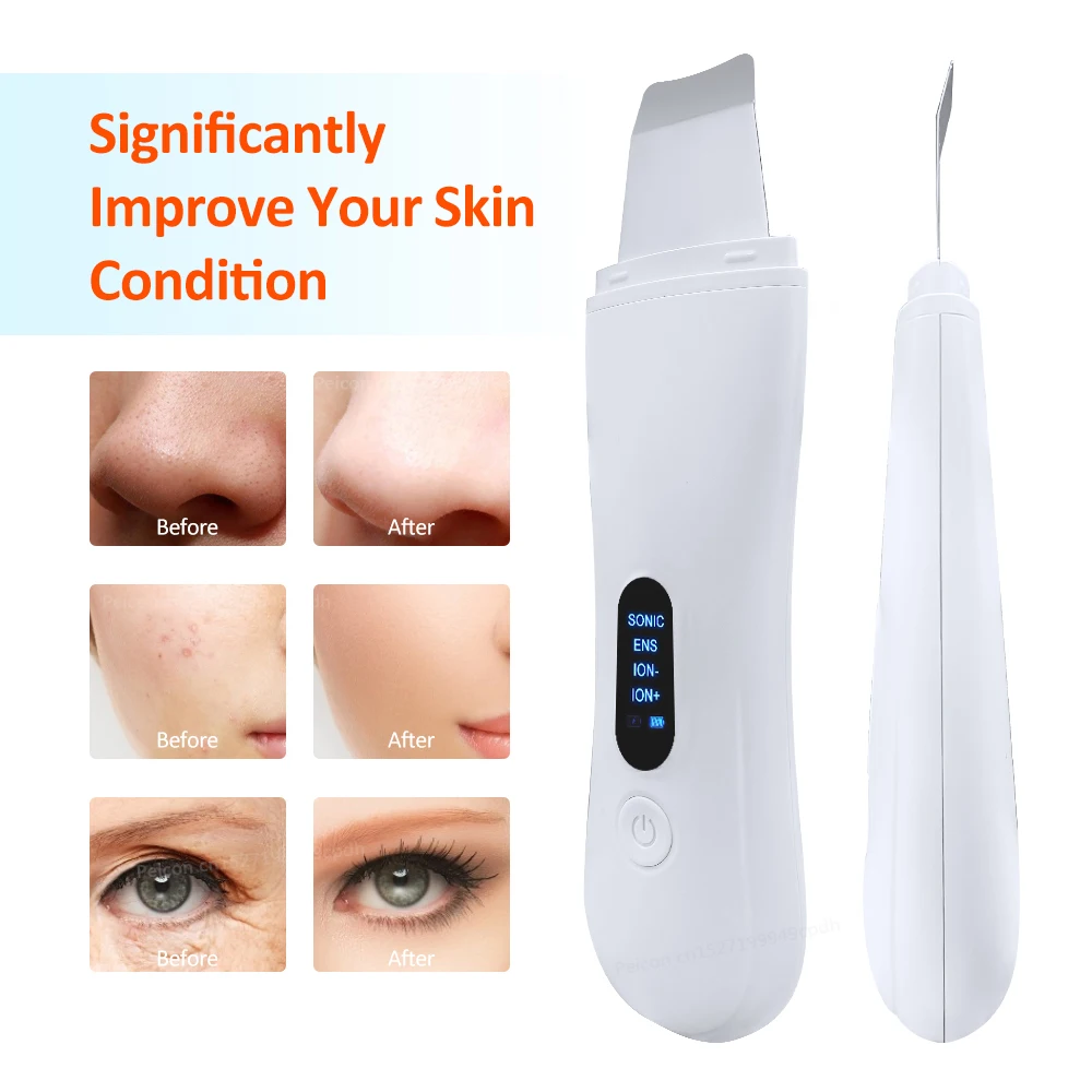 Ultrasonic Skin Scrubber Peeling Blackhead Remover Ion Acne Pore Cleaner Deep Face Cleaning Ultrasonic Facial Shovel Scrubber