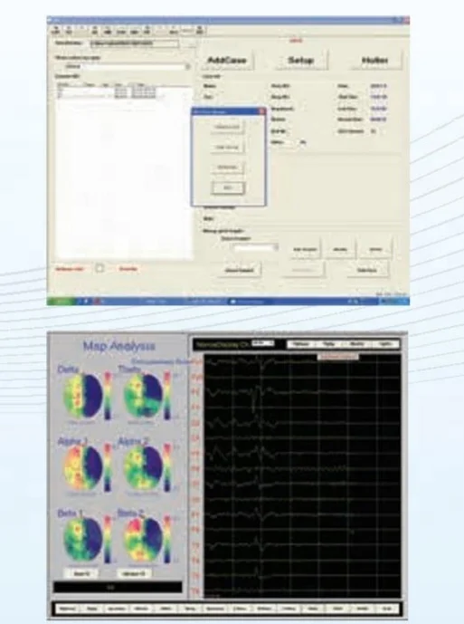 24/32/64 Channel EEG Machine/ Digital Electroencephalograph  Medical Equipment Portable