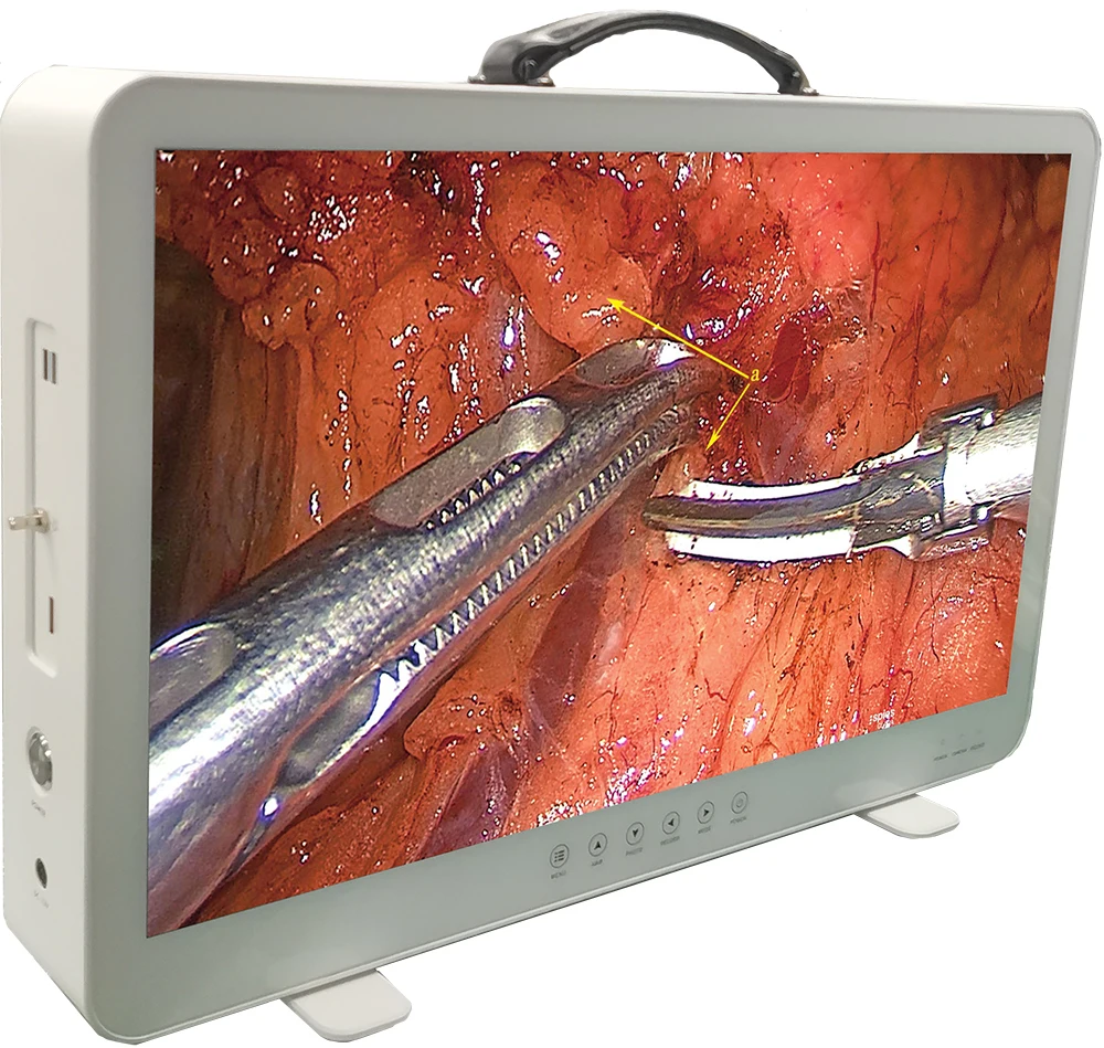 all in one telepack medical endoscope camera video endoscopy camera with cold light source