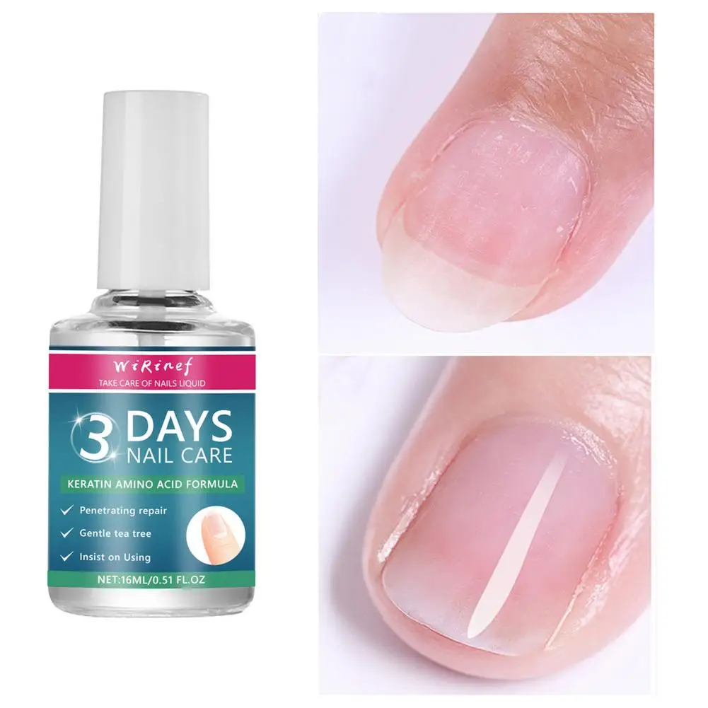 Aceite para el Cuidado de las Uñas de 3 Días, Fórmula de Queratina y Aminoácidos, Secado Rápido, Brillo de Salón en 90s, Sin Desprendimiento, Hidratación Profunda, Fortalecedor de Uñas
