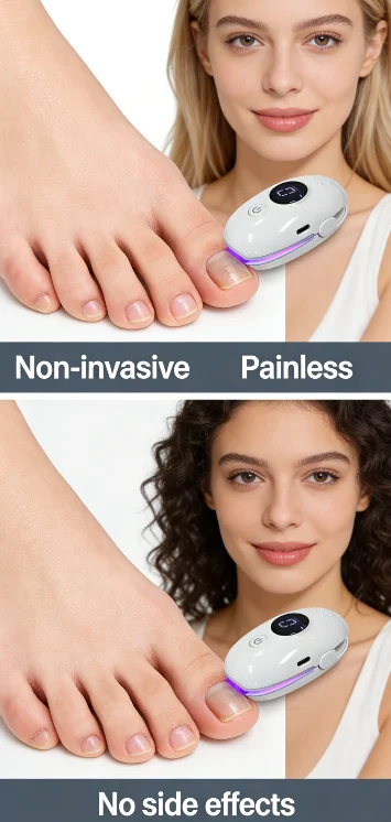 Onychomycosis Remover Laser Device HZJ02, USB-C Rechargeable, Repair Brittle Damaged Fungal Nails at Home