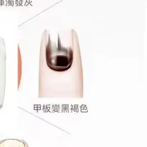 

Best Selling Nail Care Device - 470nm 905nm Dual Light Nail Fungus Treatment Equipment for Fungal Infections