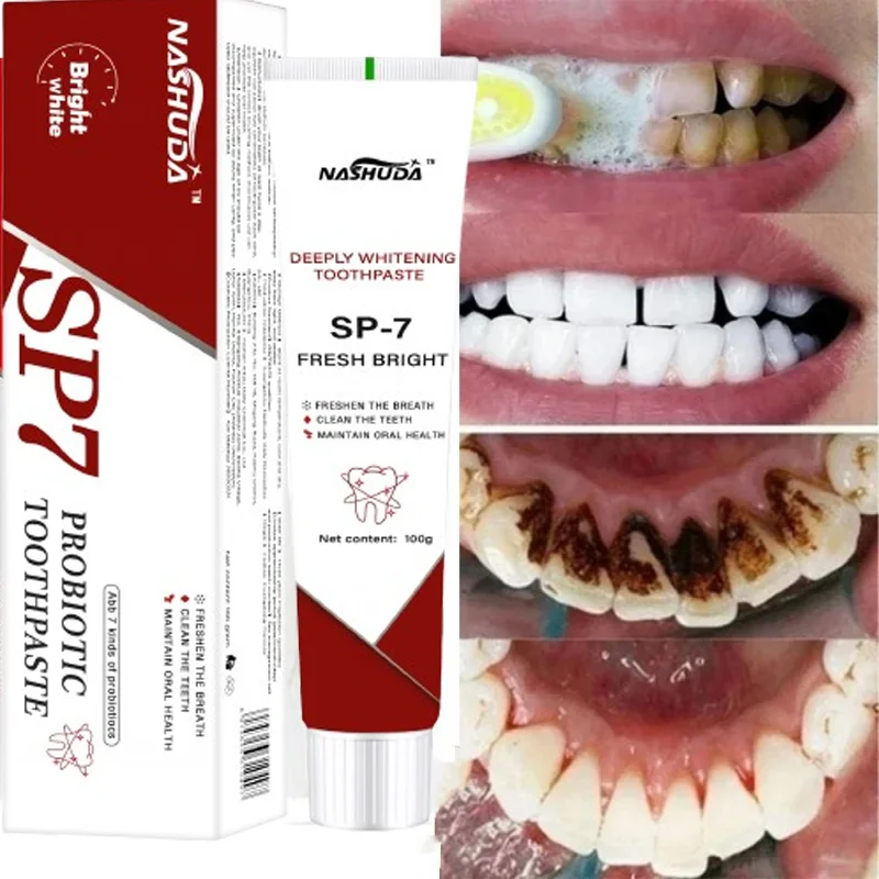 Sp-7 pasta de dente probiótica removendo mau hálito manchas de dentes amarelos iluminar clareamento hálito fresco produto de gerenciamento de saúde bucal