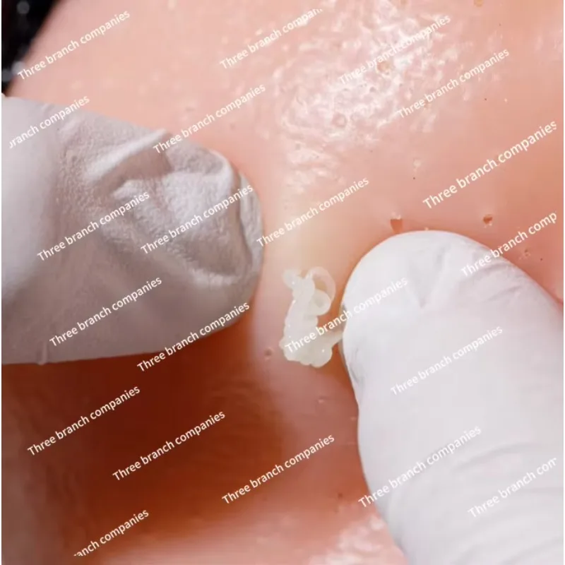 Squeeze blackhead artifact toy decompression and cleaning upgraded version of bursting acne replaceable acne simulation doll