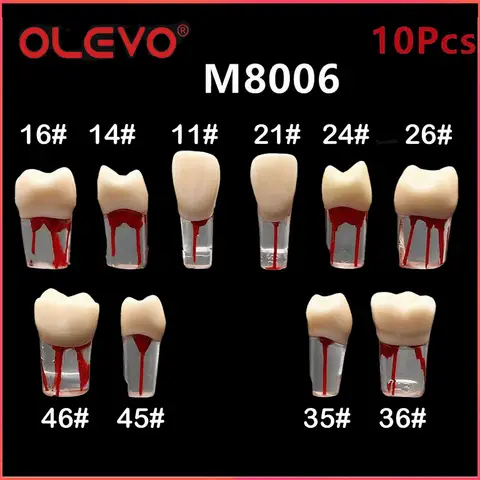 OLEVO 10 Pcs 치과 RCT 엔도 치아 모델 근관 근관 블록 펄프 캐비티 수지 연구 연습 근관 치료 훈련 M8006