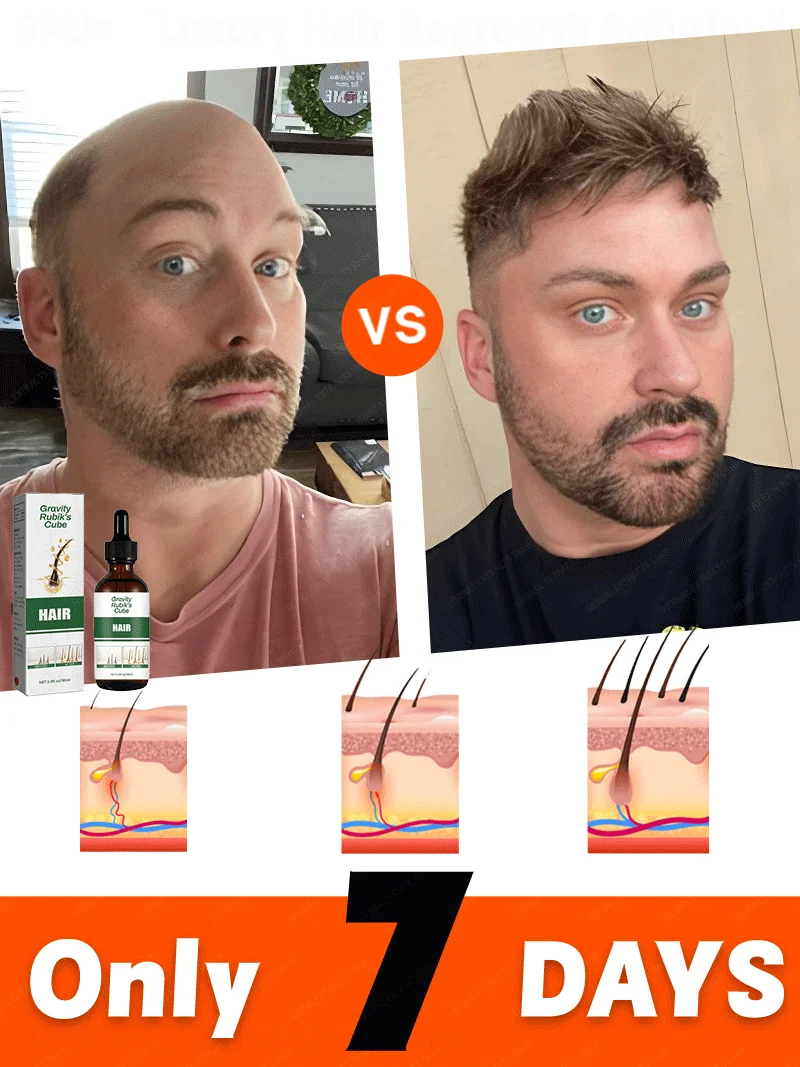 

This is absolutely the most effective hair growth product of the 21st century, which has helped millions of people get rid of ha