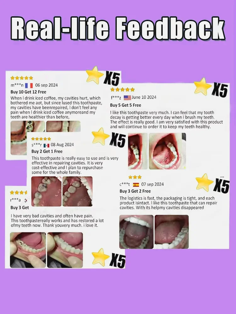 تحتوي على بروبيوتيك لإصلاح تسوس الأسنان ونظيف الأسنان #6