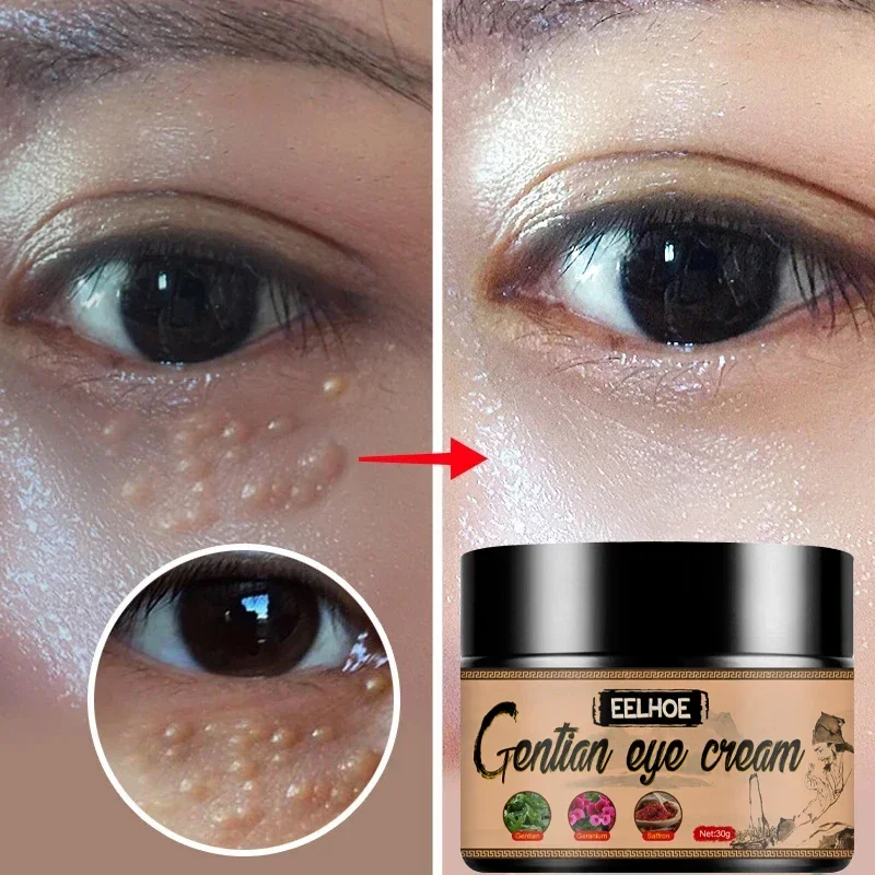 Fat Granules Remover Eye Cream Remove Dark Circles Eye Bags Fade Fine Lines Anti-Puffiness Wrinkles Lift Firming Eye Skin Care