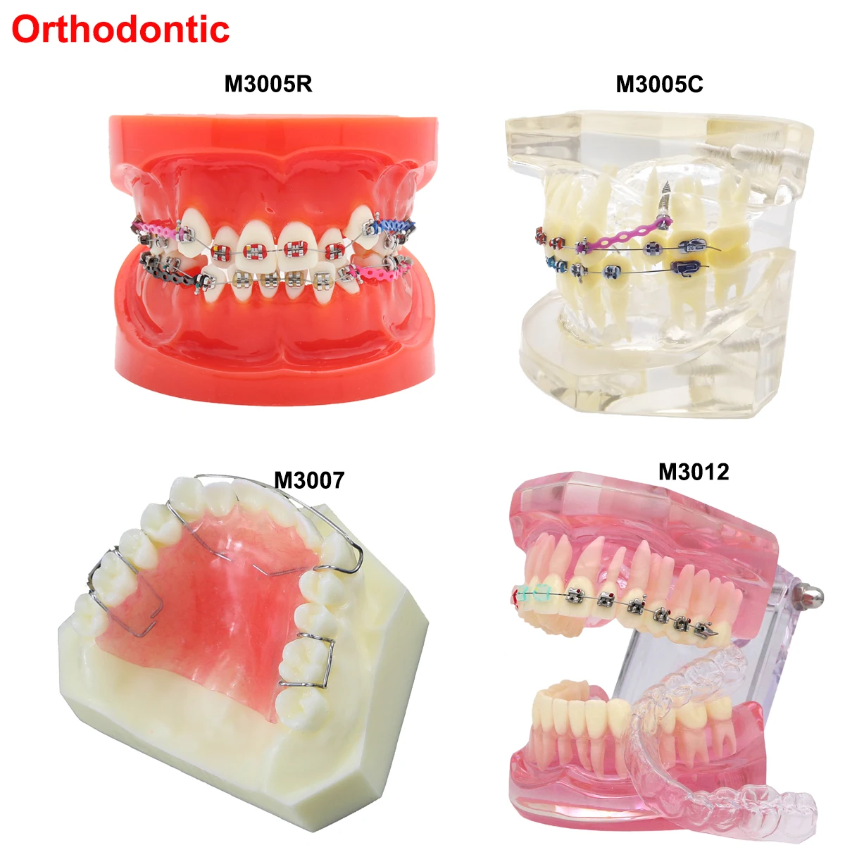 Modelos dentales de varios tipos, modelo de enseñanza Dental para entrenamiento, estudiar implante de ortodoncia, material de odontología