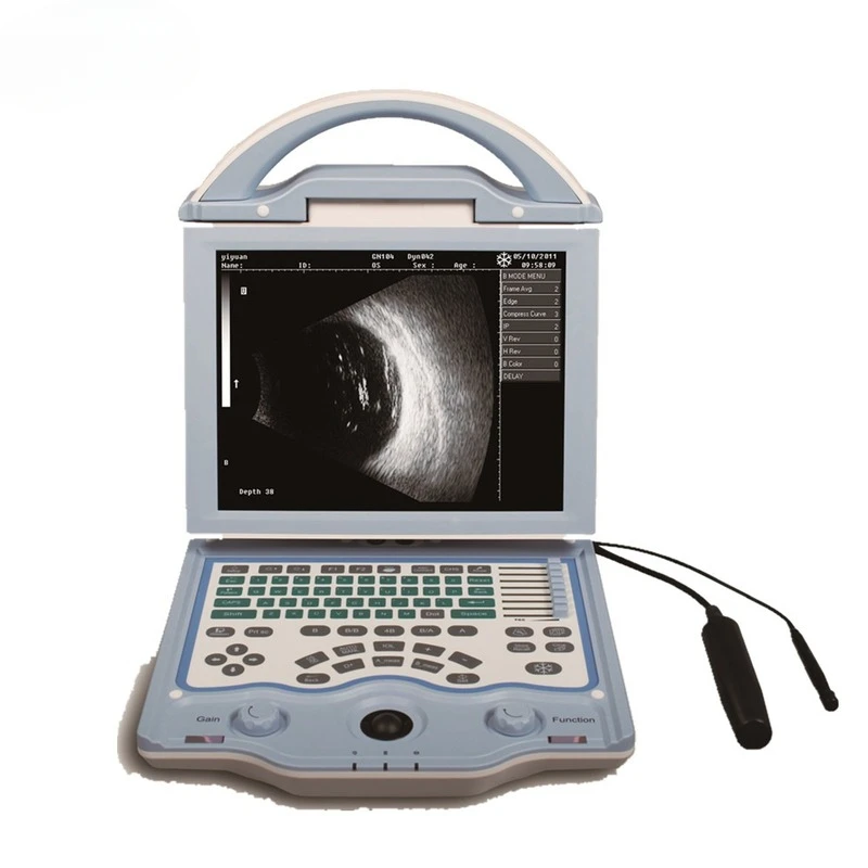 China Lowest price Ophthalmic Ultrasound a b Scan Medical Equipment for biometry eye test in ophthalmology