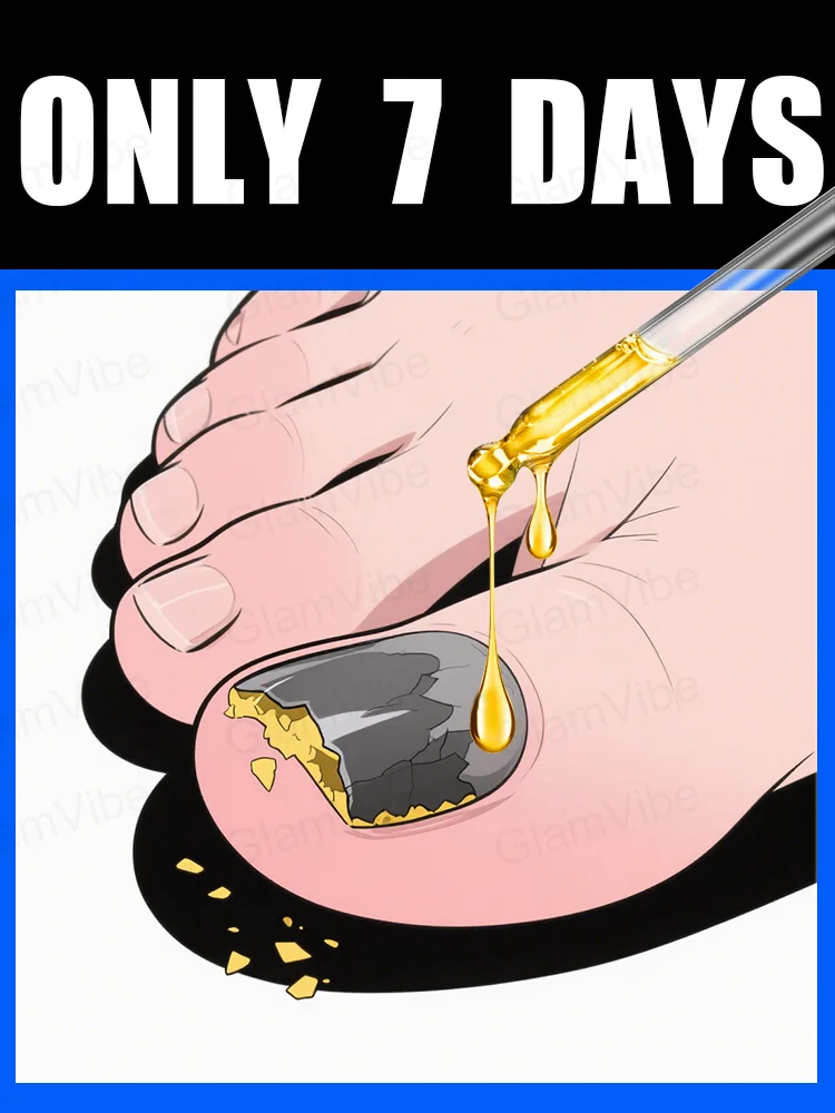 

Быстро устраняет грибку и восстанавливает здоровые ногти.