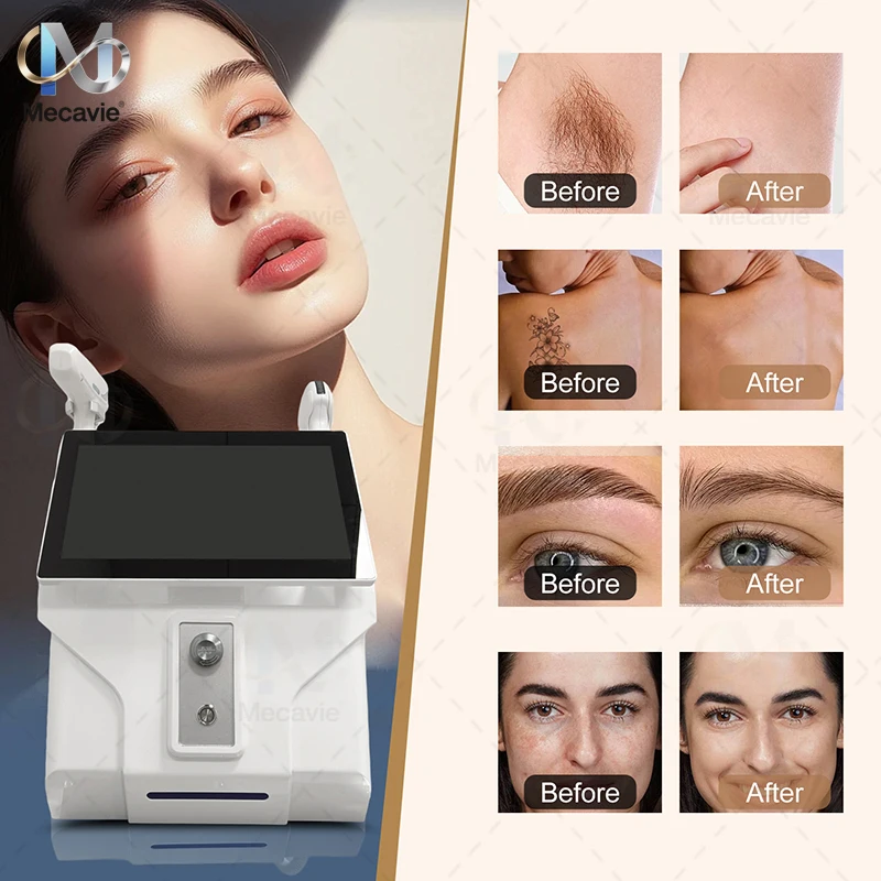 

Усовершенствованный пикосекундный диодный лазер 4000 Вт, 4 длины волны, 2 в 1, машина для удаления татуировок, система ледяного охлаждения 2026, новая модель