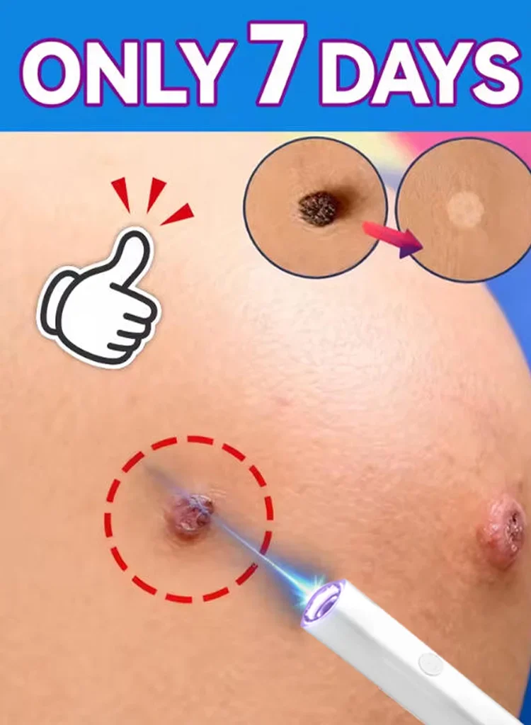 2nd ᵍᵉⁿᵉʳᵃᵗⁱᵒⁿ ᵘᵖᵍʳᵃᵈᵉᵈ wᵃʳᵗ ⸴ ᑫᵘⁱᶜᵏˡʸ， ʳᵉpᵃⁱʳ wᵃʳᵗˢ ʳᵒoᵗ