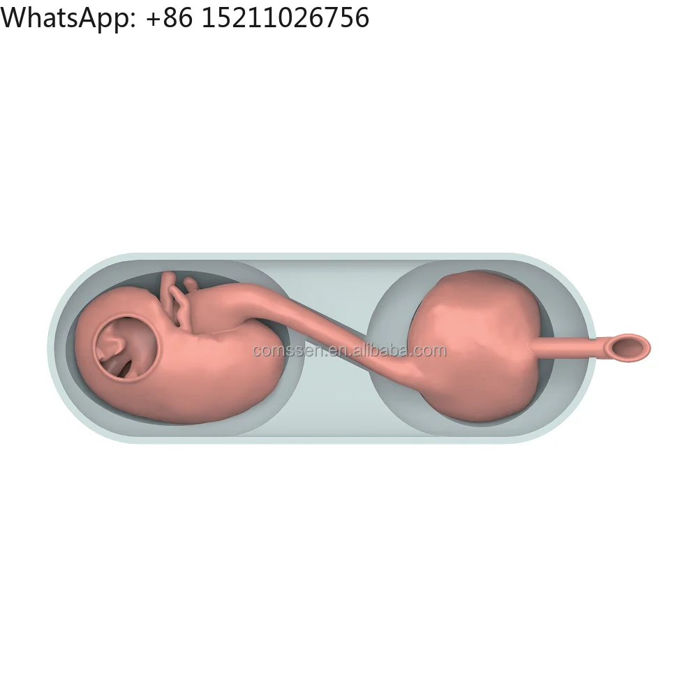 Simulation System of Cystoscope Operation