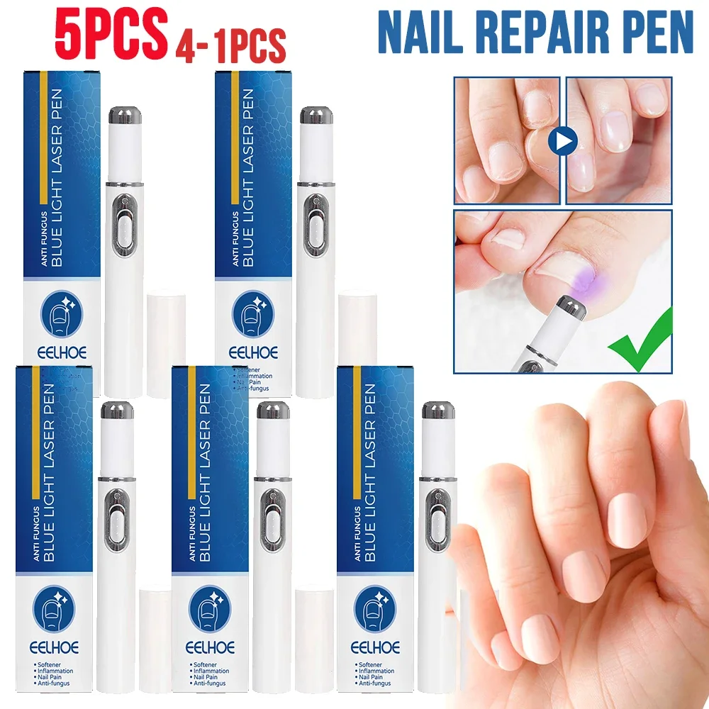 1-5Pc Blue Laser Nail Fungal Pen Anti-fungal Home Toe Nail Onychomycosis Paronychia Anti Fungal Fungus Care Repair Painless Nail