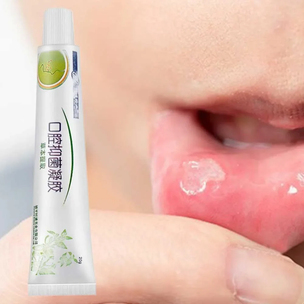 Mouth Ulcer Relief Gel Natural Herbal Oral Hygiene Antibacterial Cream Severe Pain Irritation Bad Breath Inflammation Creatina