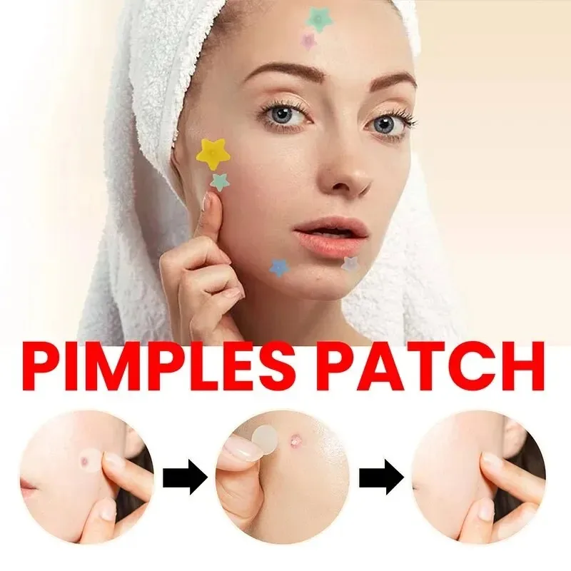 200pcs Repair Acne Patch Facial Skin Care Fade Blemishes Pimple Marks Closed Acne Blemishes Cover Acne Pimple Repair Patch