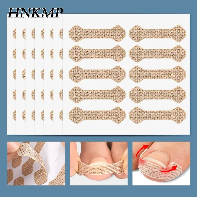 60pcs Ingrown Paronychia Toenail Corrector Strips Anti Nail Patch Feet Sleeping Nail Patch Nails Into The Flesh Long Toe Pad