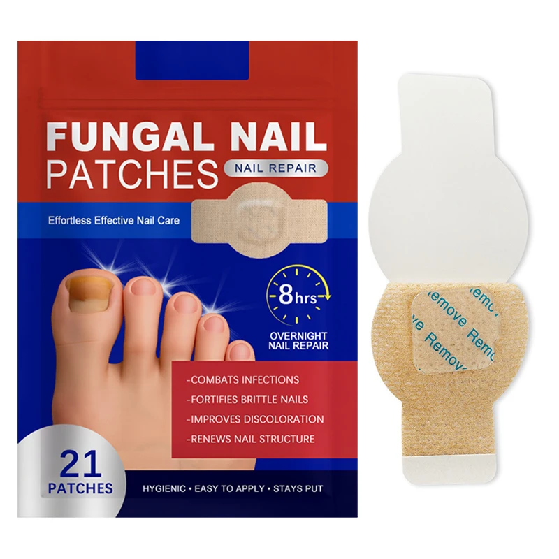 21 pieces of onychomycosis stickers waterproof nail repair stickers nail ingrown nail correction stickers foot care tools
