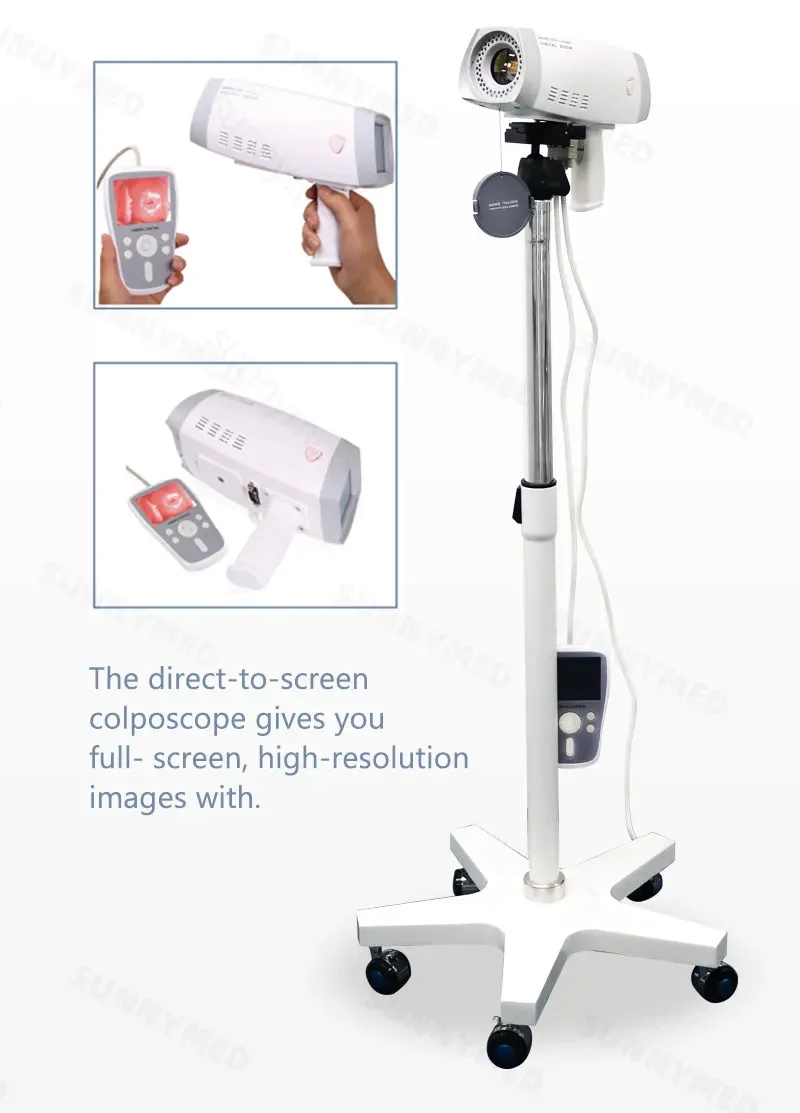 SUNNYMED SY-F005 Hospital Gynecology Digital Colposcope with Video  Price