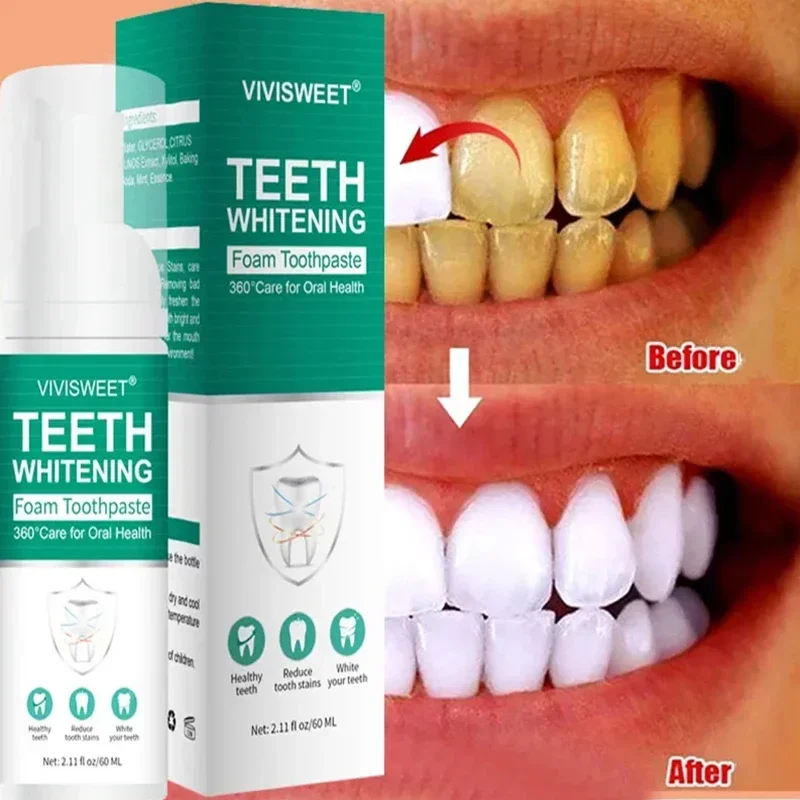 V34 Teeth Whitening Oral Hygiene Tooth Care Products Remove Plaque Tooth Stain Gingival Repair Caries Prevention Oral Cleaning